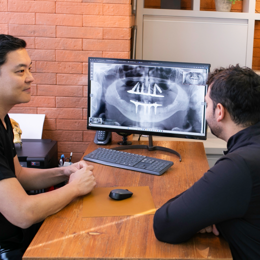 6-implantes-dentarios
